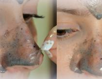 How to clean clogged pores on your face at home