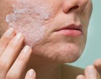 В чем польза и есть ли вред от пилинга для кожи лица: что необходимо знать