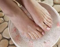 Traditional treatment for toenail fungus